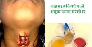 थाइराईडको अचुक औषधि